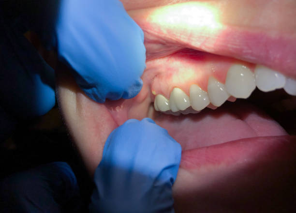 Best Emergency Treatment for Jaw Pain or Injury in Audubon Park, NJ