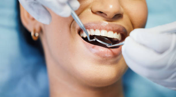 Best Emergency Cosmetic Dentistry (e.g., broken veneers) in Audubon Park, NJ